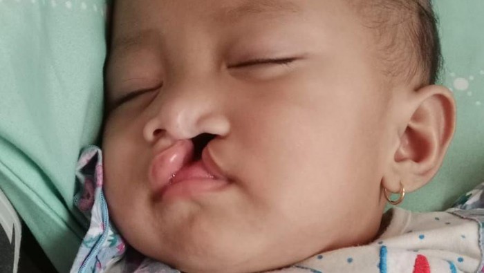 Khalisa, Balita Dengan 3 tahap Perjuangan, Coba Dukung!
