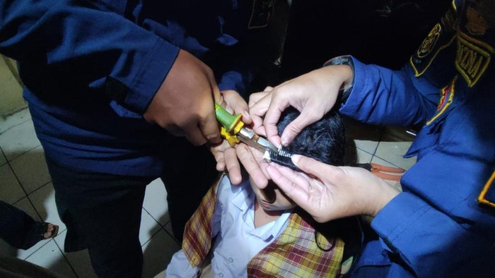 Rambut Siswi TK di Bogor Terlilit Sisir, Ortu Datangi Damkar - Update 2