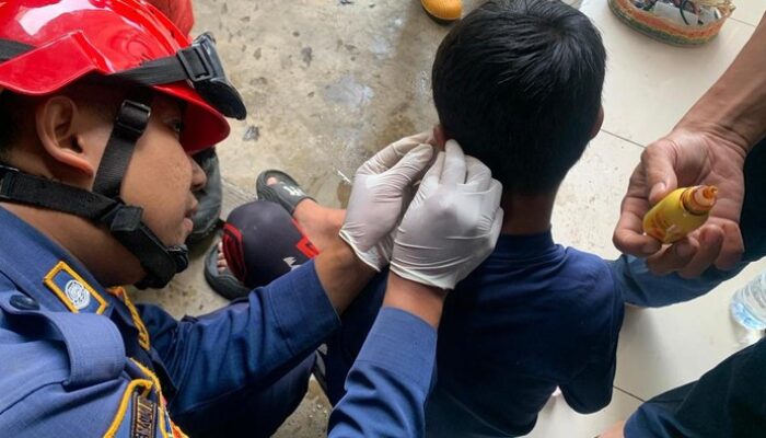 Tak Terduga! Kail Pancing Nyangkut di Telinga Bocah Asal Bogor, Minta Pertolongan Darurat!