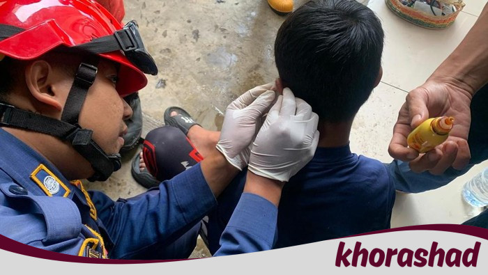 Tak Terduga! Kail Pancing Nyangkut di Telinga Bocah Asal Bogor, Minta Pertolongan Darurat!