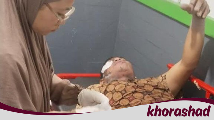 **Pasutri di Lumajang Jadi Korban Awan Panas Semeru, Luka Bakar 20%**